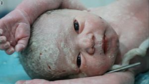 الطفل لحظة ميلاده