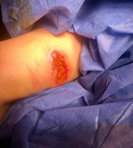 فريق طبي بمستشفى ابوالمنحا ينقذ حياة طفلين تعرضوا لعقر كلب